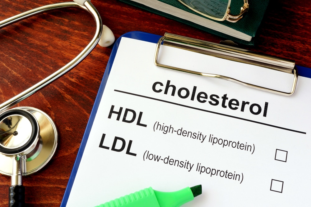 Managing High Cholesterol